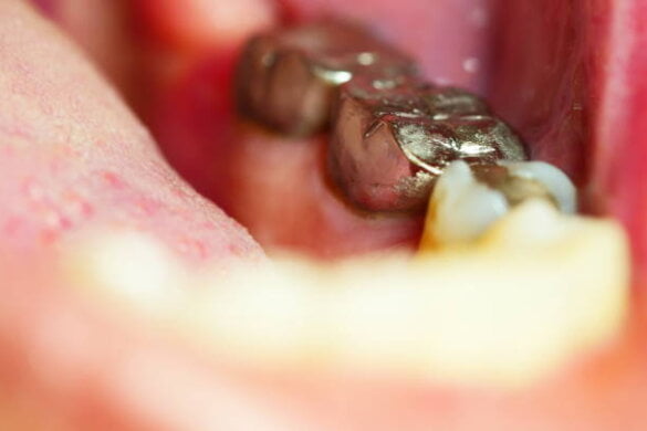 Grillz
