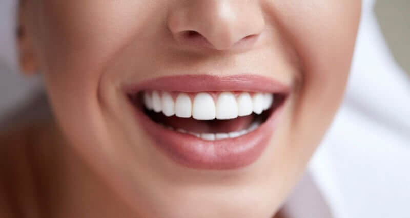 Know All About Different Types of Braces and Which One to Go For